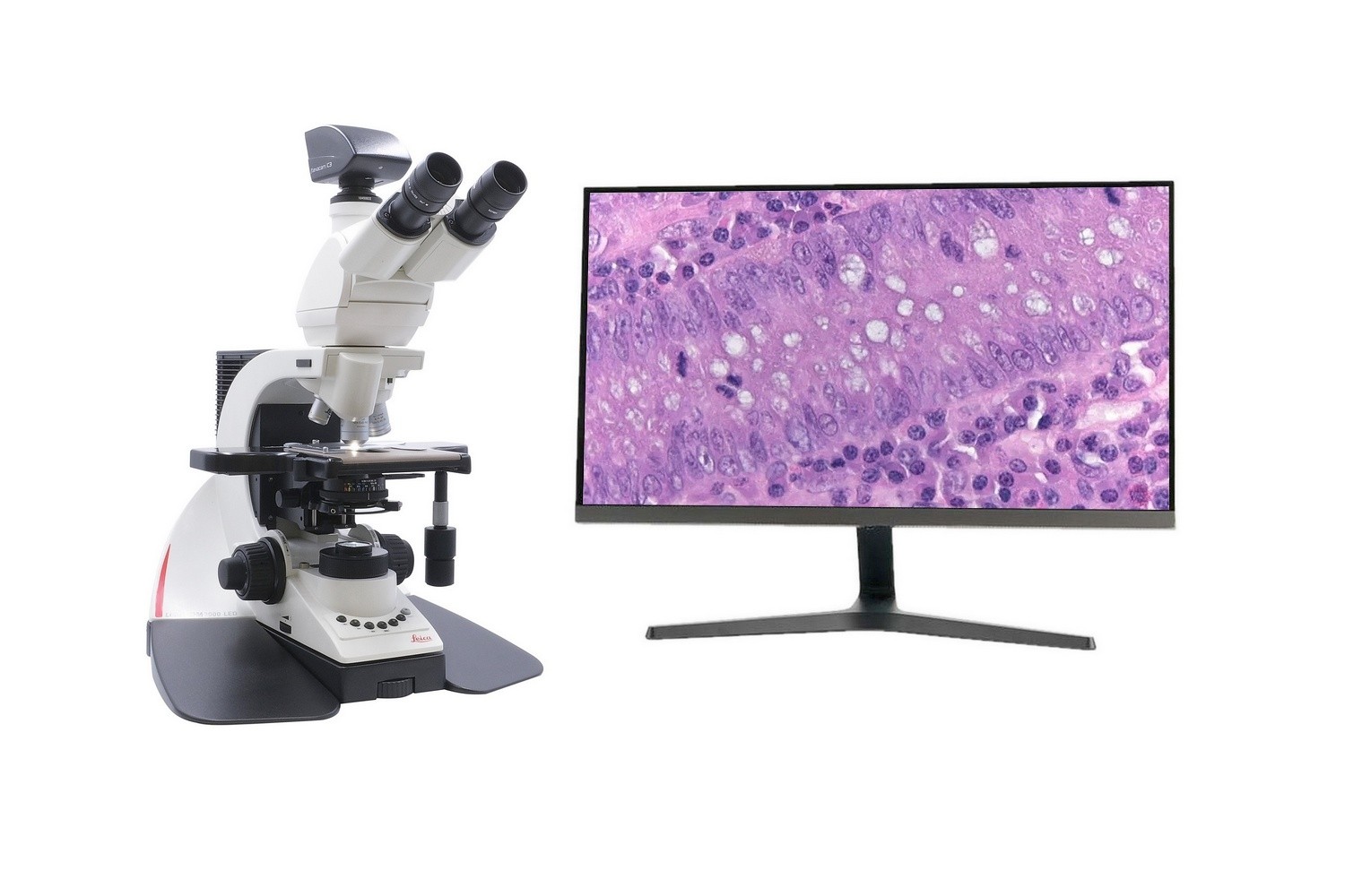 Leica DM3000 LED für Pathologie mit Monitor