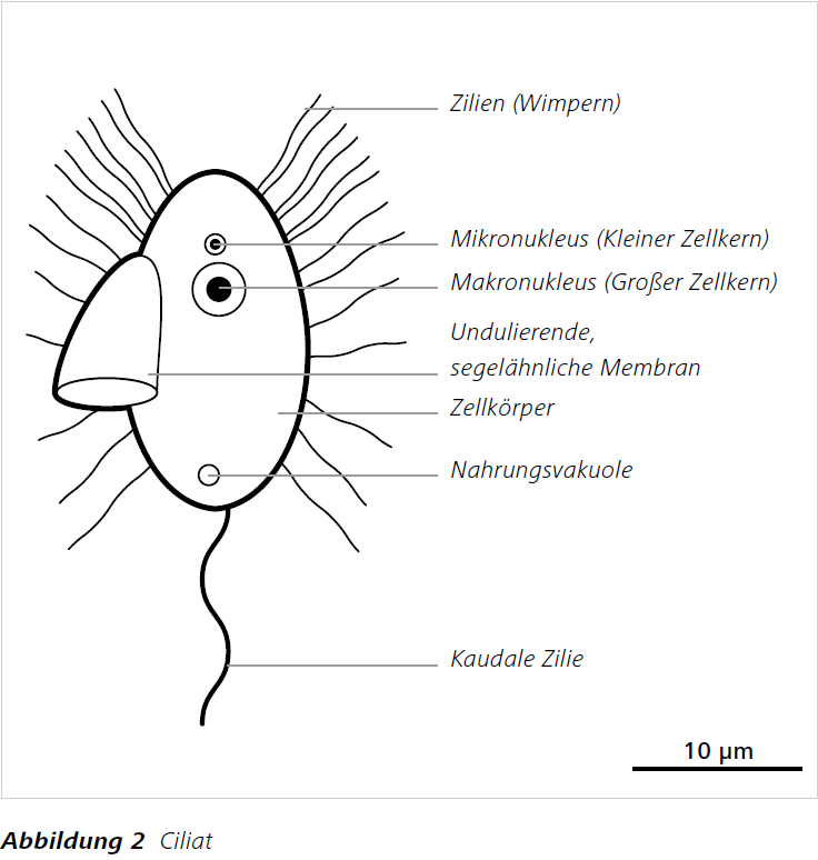 Abbildung 2 Ciliat