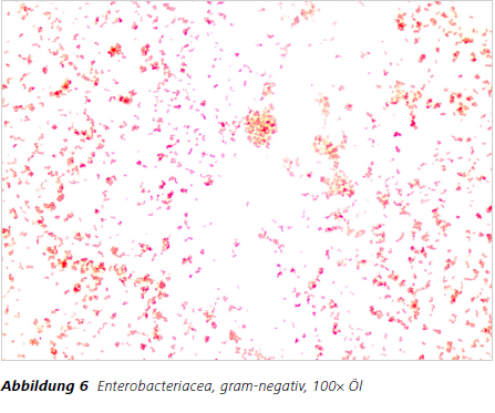 Abbildung 6 Enterobacteriacea, gram-negativ, 100× Öl 