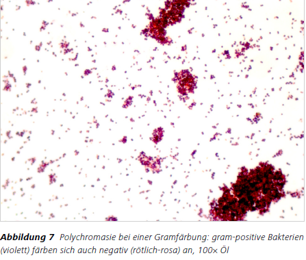 Abbildung 7 Polychromasie bei einer Gramfärbung: gram-positive Bakterien (violett) färben sich auch negativ (rötlich-rosa) an, 100× Öl