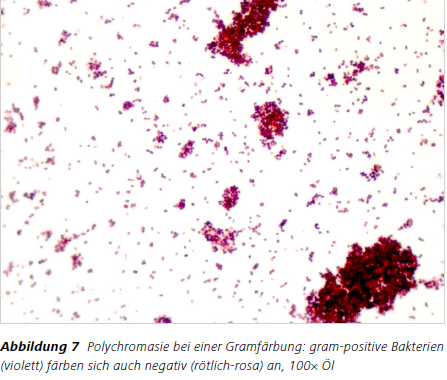 Abbildung 7 Polychromasie bei einer Gramfärbung: gram-positive Bakterien (violett) färben sich auch negativ (rötlich-rosa) an, 100× Öl 