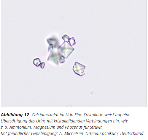 Abbildung 12 Calciumoxalat im Urin Eine Kristallurie weist auf eine
Übersättigung des Urins mit kristallbildenden Verbindungen hin, wie z. B. Ammonium, Magnesium und Phosphat für Struvit. Mit freundlicher Genehmigung: A. Michelsen, Ortenau Klinikum, Deutschland
