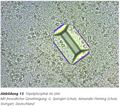 Abbildung 13 Tripelphosphat im Urin Mit freundlicher Genehmigung: G. Spengler-Schulz, Alexander Fleming Schule, Stuttgart, Deutschland